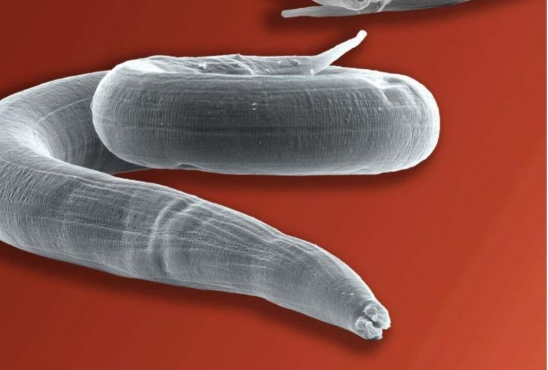 pinworm no cilvēka ķermeņa